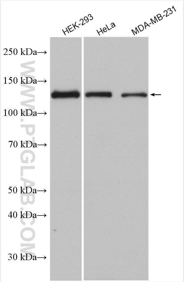 WB analysis using 13161-1-AP