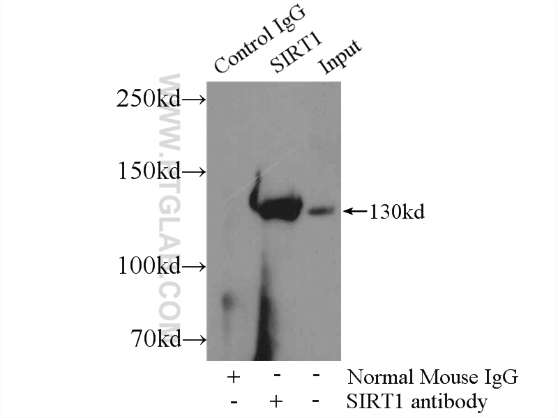 IP experiment of HeLa using 60303-1-Ig (same clone as 60303-1-PBS)