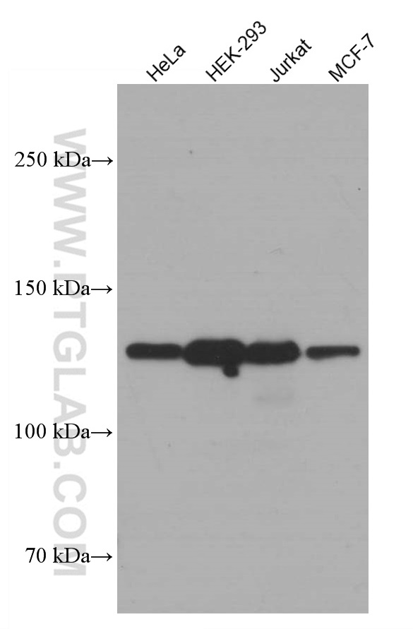 WB analysis using 60303-1-Ig