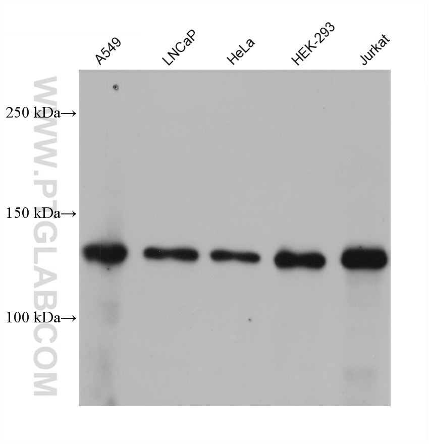 WB analysis using 60303-1-Ig