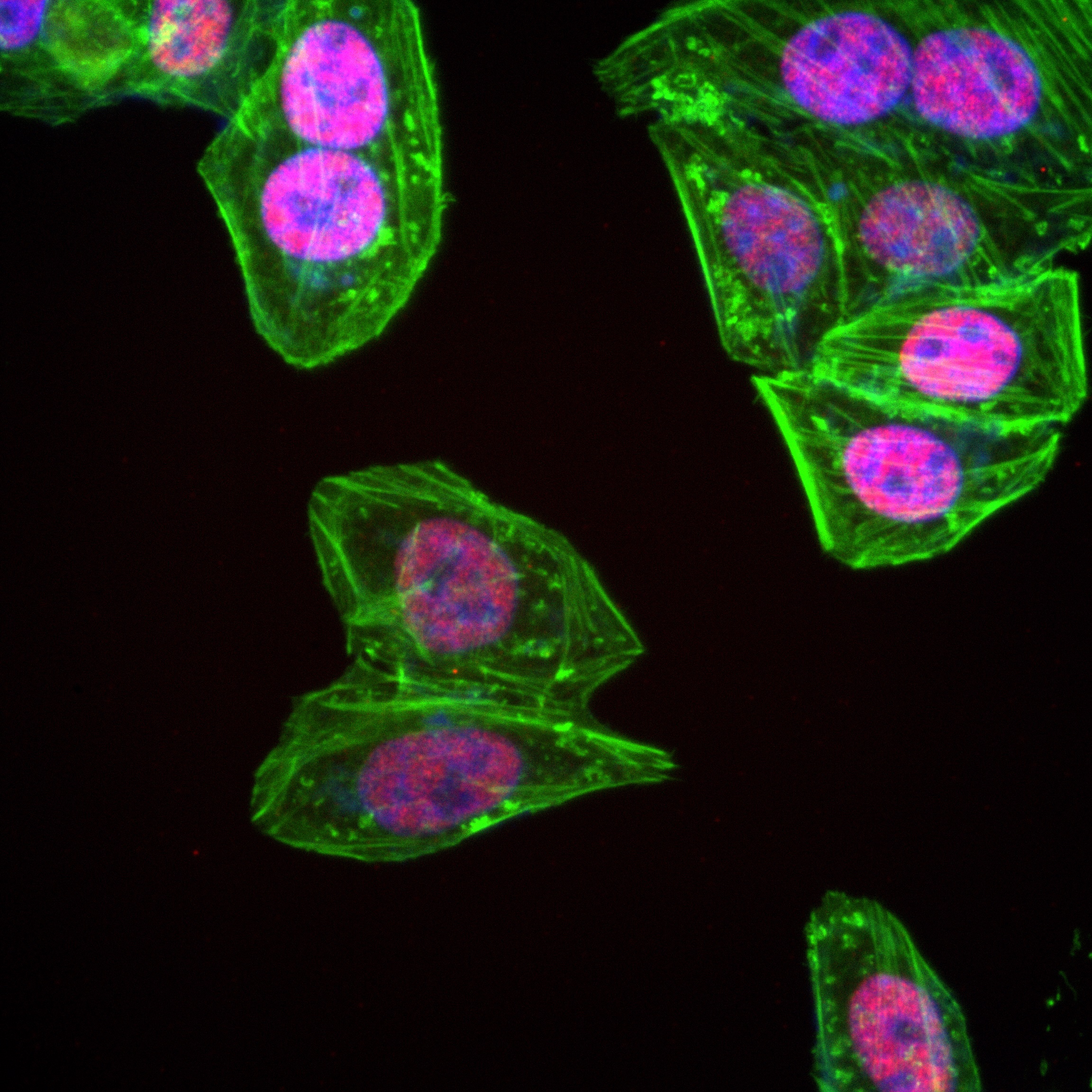 IF Staining of HepG2 using 82790-4-RR (same clone as 82790-4-PBS)