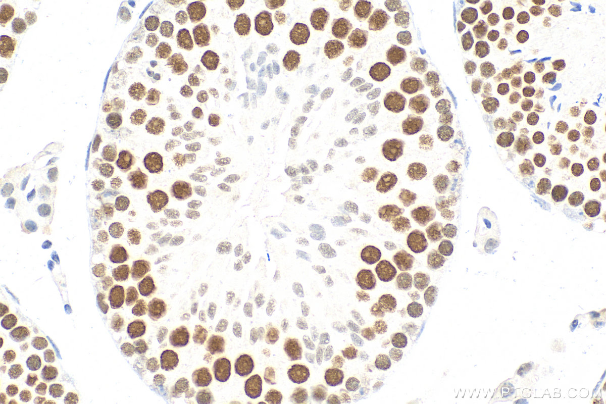 IHC staining of mouse testis using RMX00009