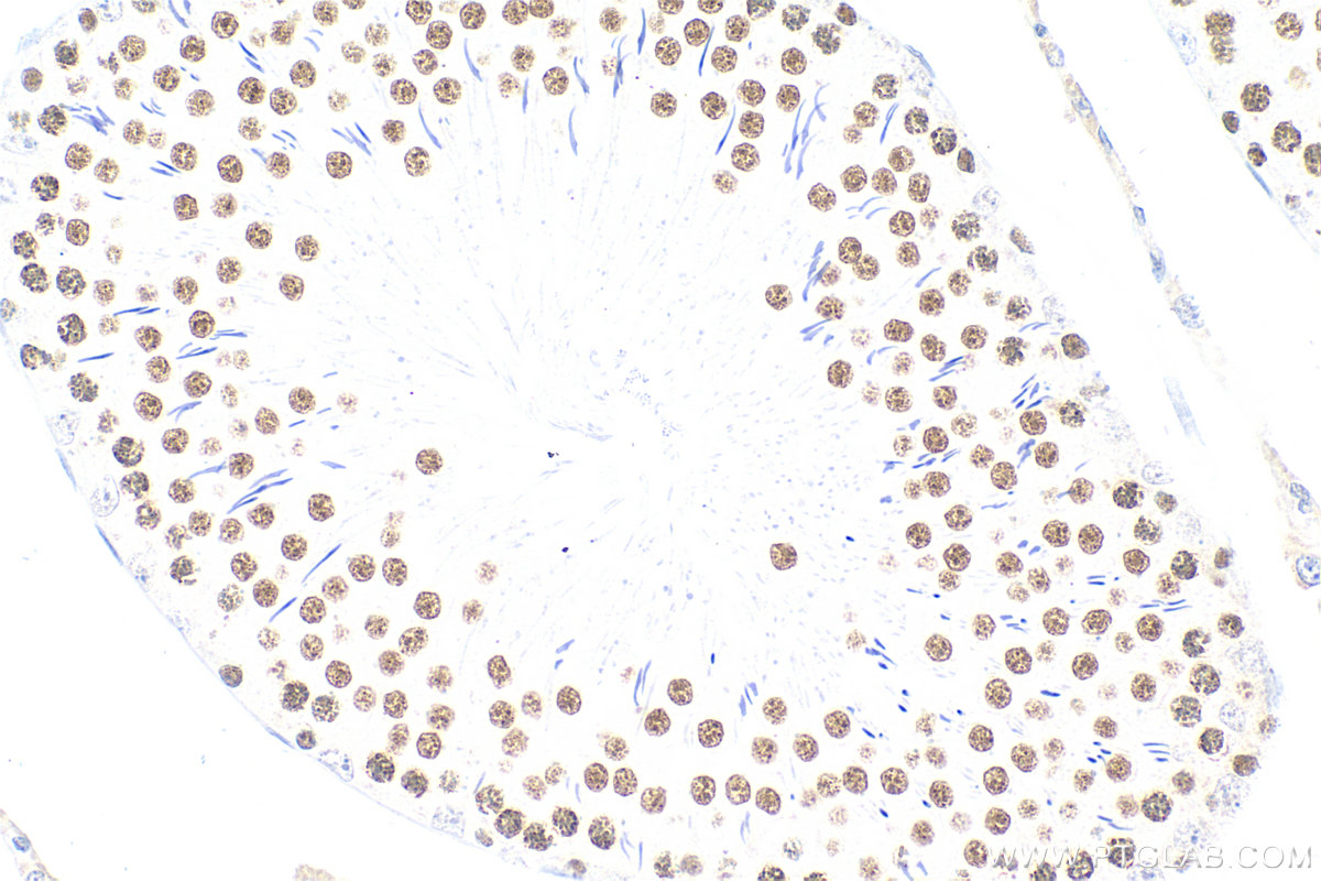 IHC staining of rat testis using RMX00009