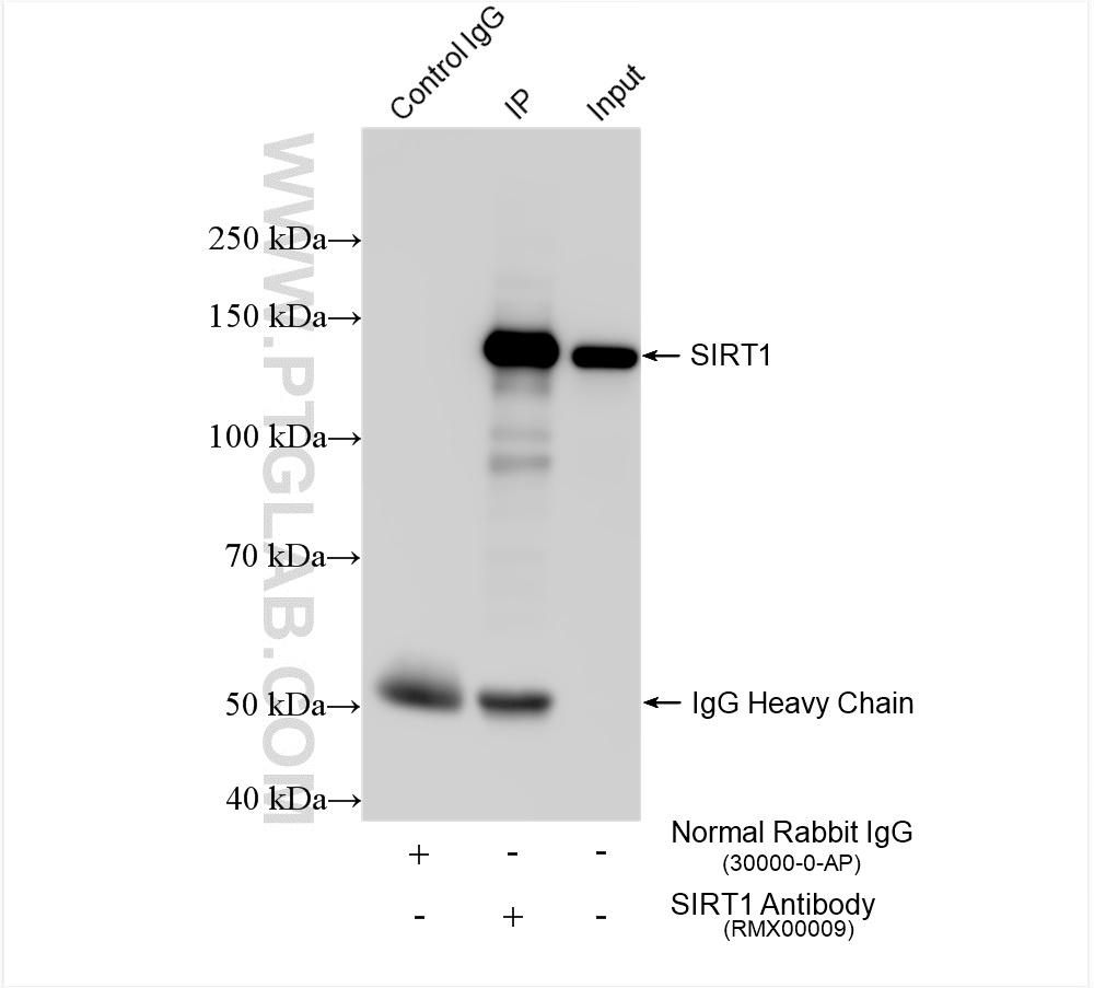 IP experiment of HeLa using RMX00009