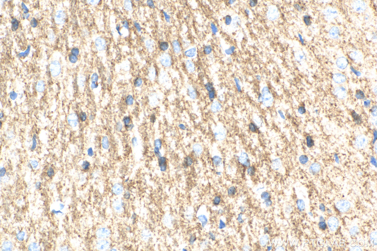 IHC staining of rat brain using 19655-1-AP