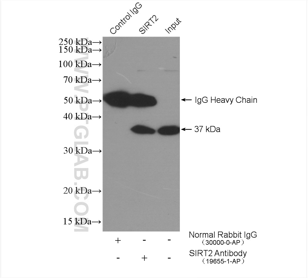 IP experiment of mouse brain using 19655-1-AP