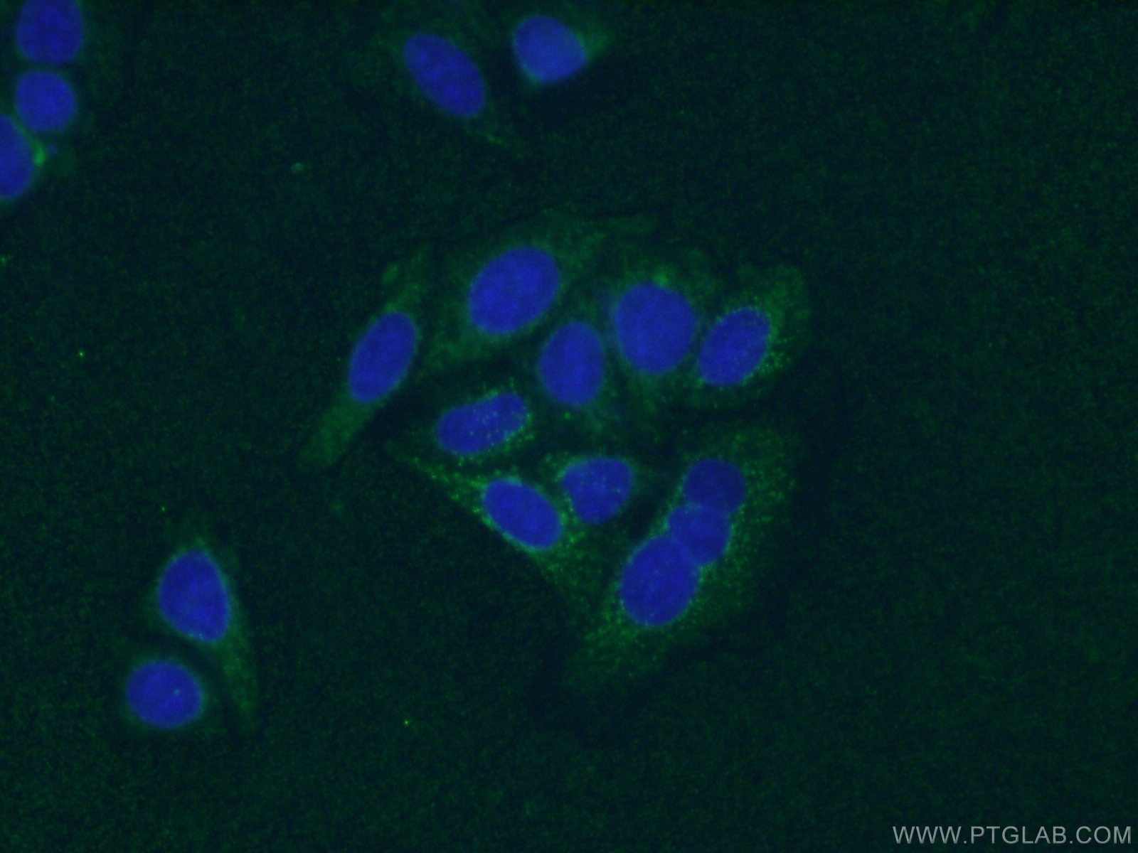 IF Staining of HepG2 using 66410-1-Ig (same clone as 66410-1-PBS)