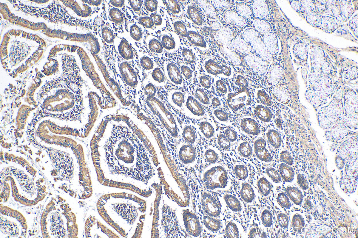 IHC staining of human stomach using 10099-1-AP