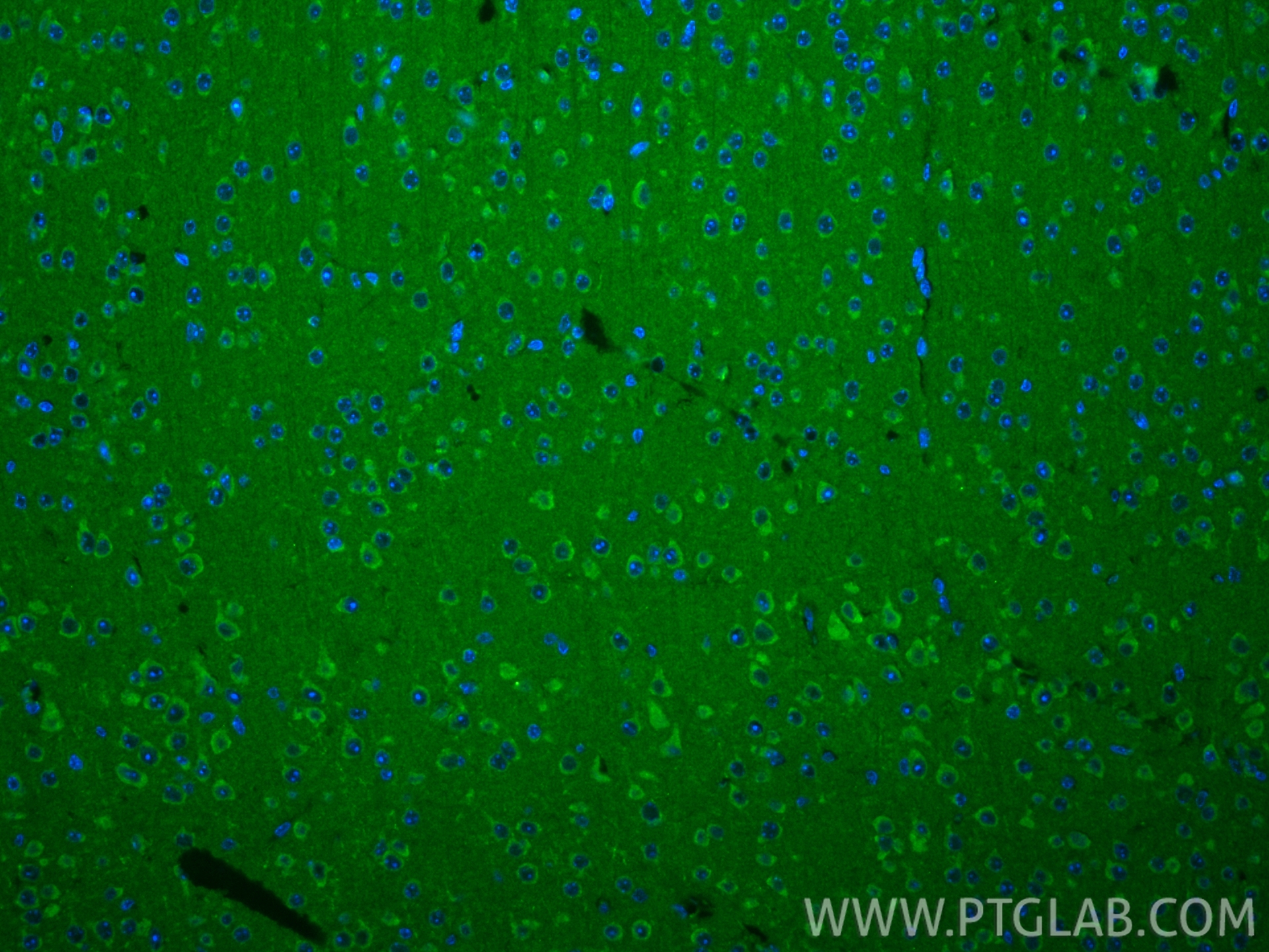 IF Staining of mouse brain using 28148-1-AP IF Staining of mouse brain using 28148-1-AP