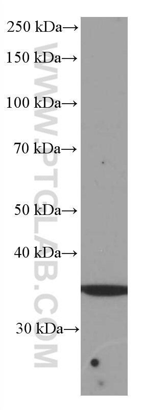 WB analysis of HeLa using 66543-1-Ig (same clone as 66543-1-PBS)