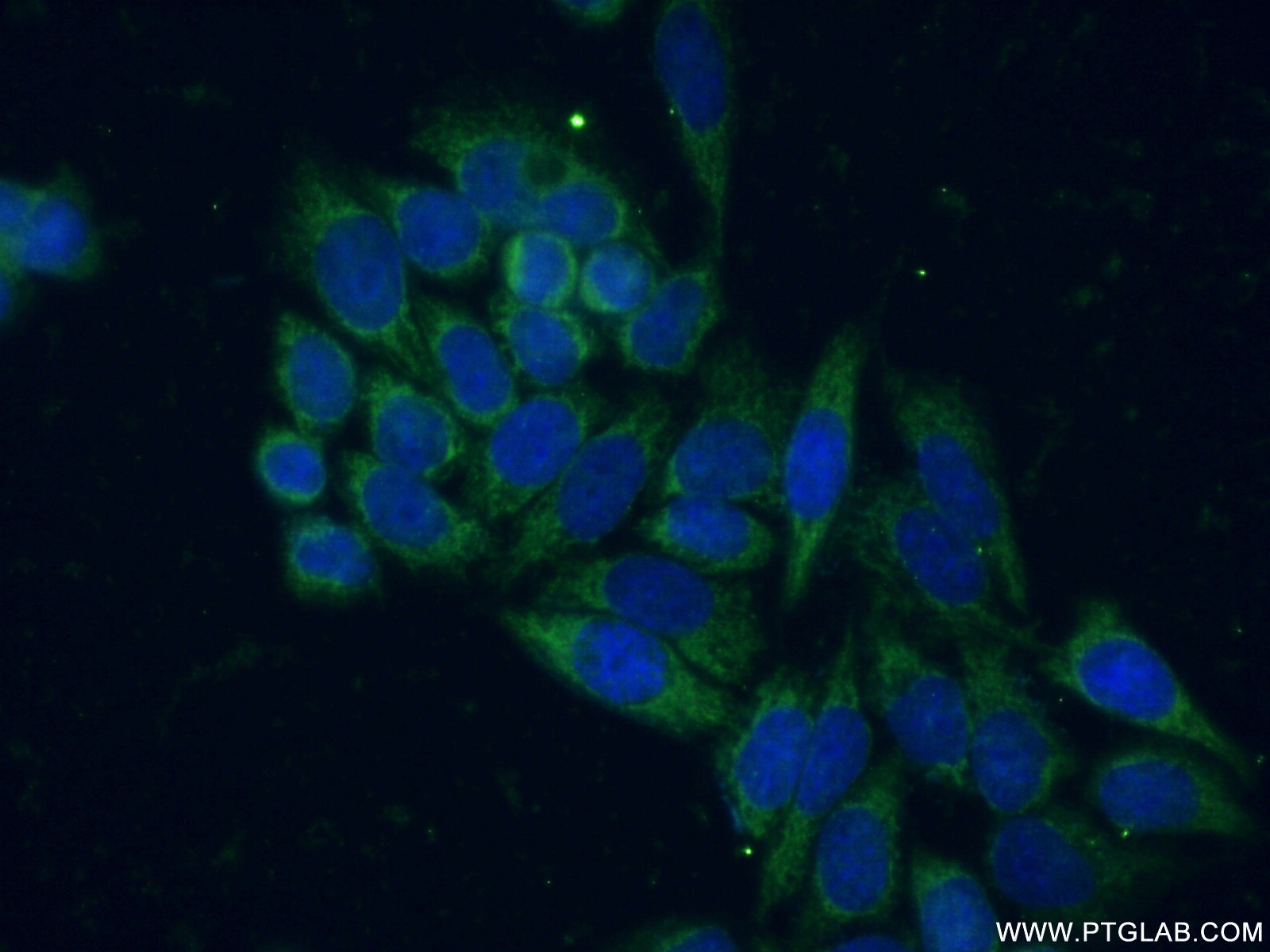 IF Staining of HeLa using 15122-1-AP