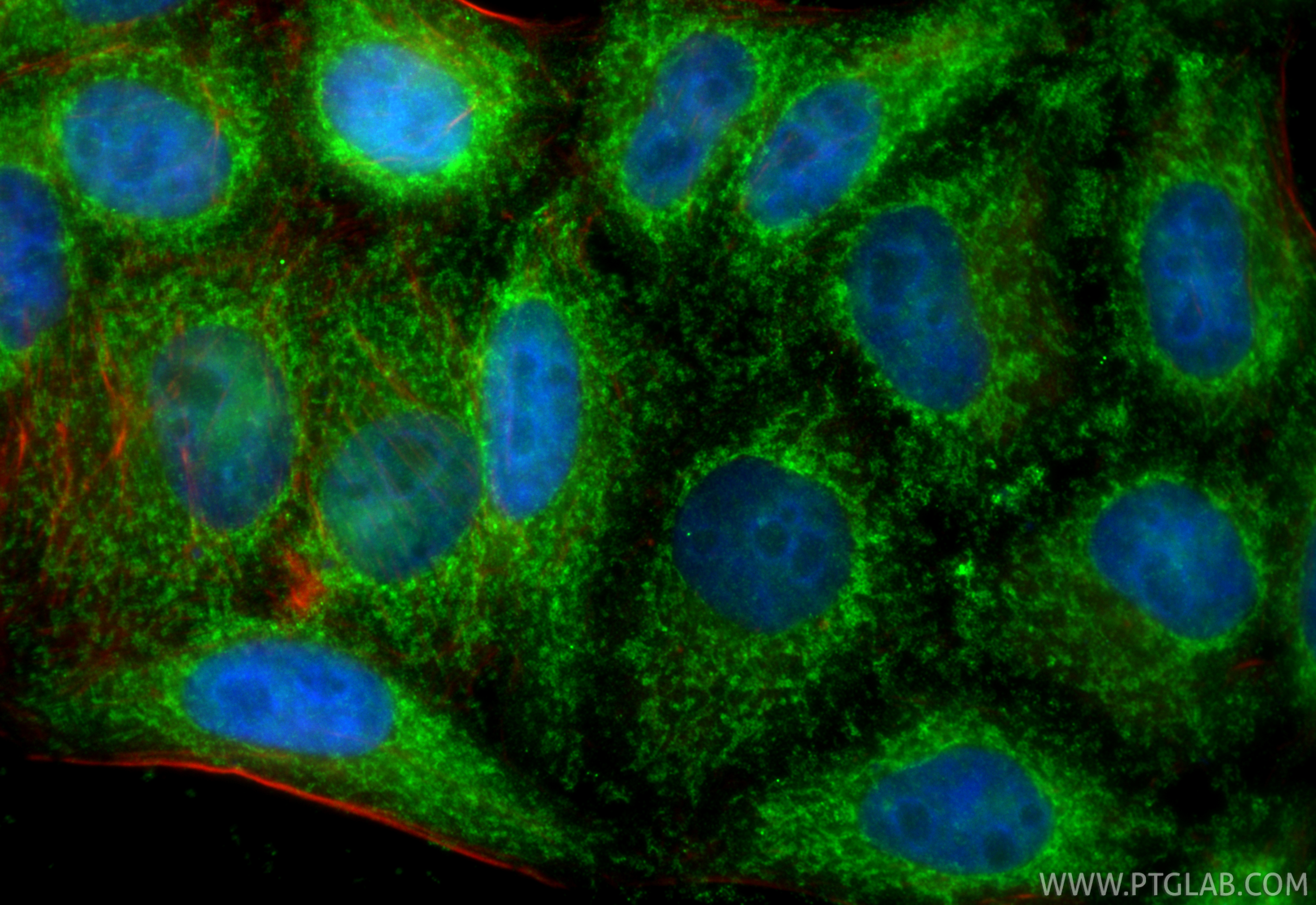 IF Staining of HepG2 using 15122-1-AP