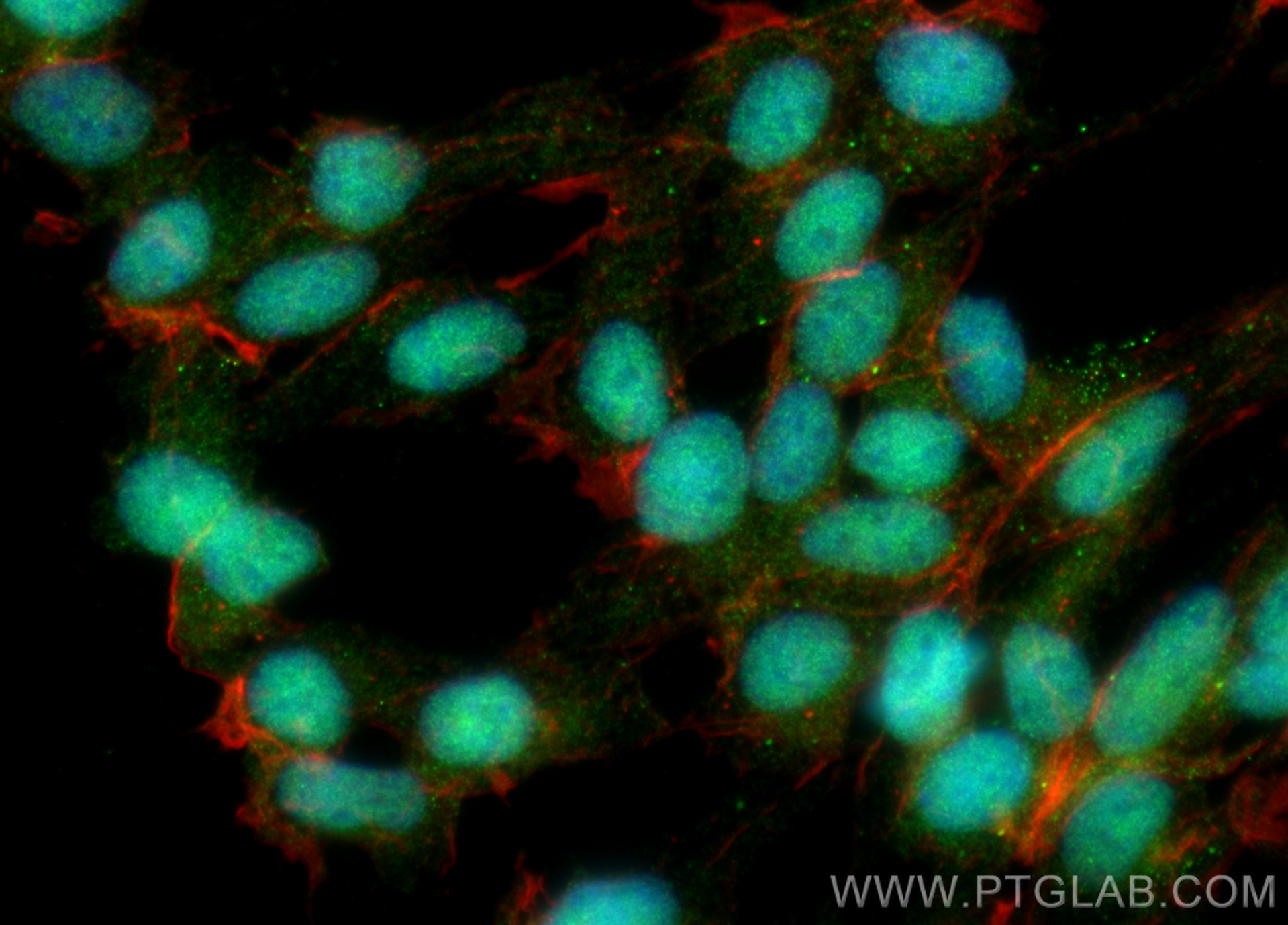 IF Staining of SH-SY5Y using 28677-1-AP