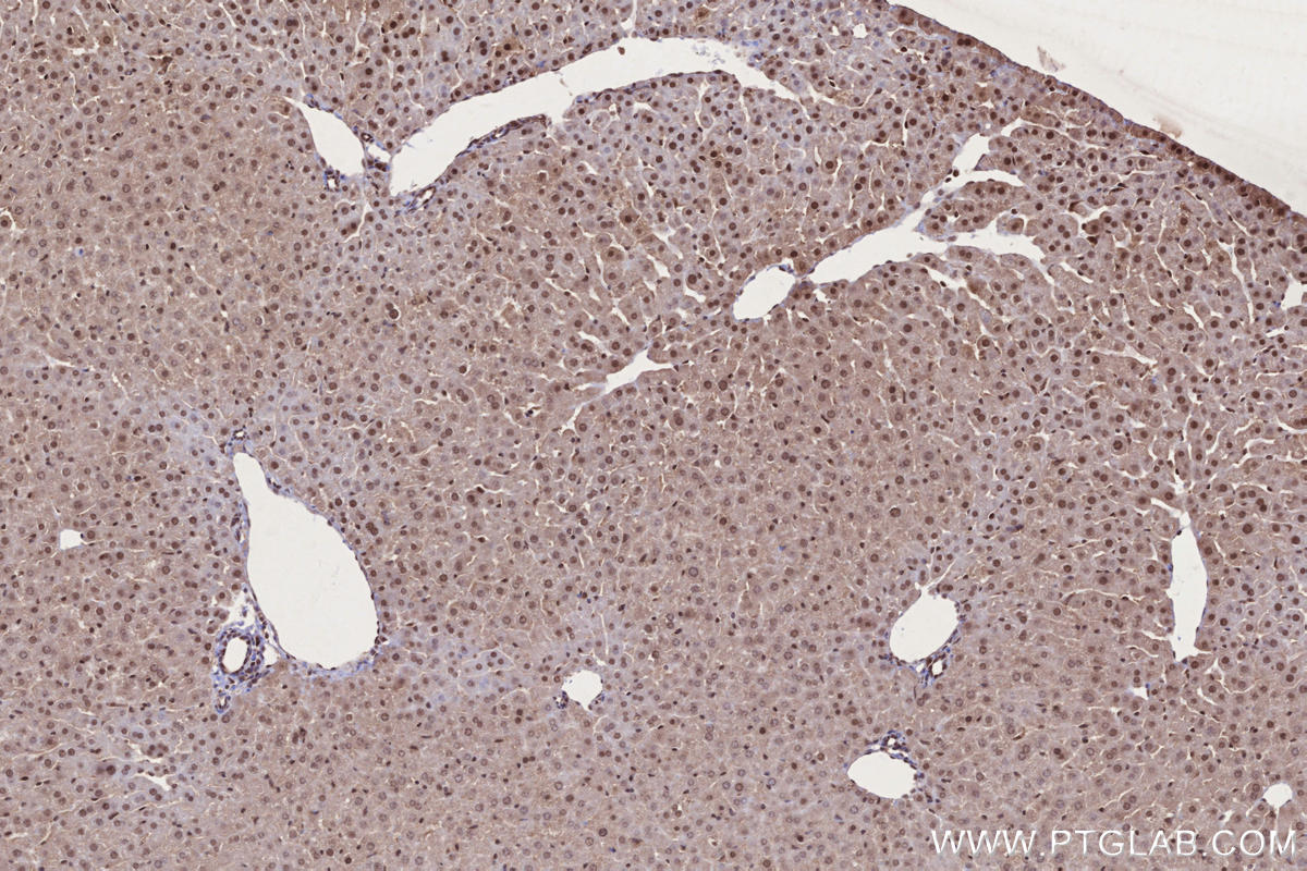 IHC staining of mouse liver using 28677-1-AP IHC staining of mouse liver using 28677-1-AP