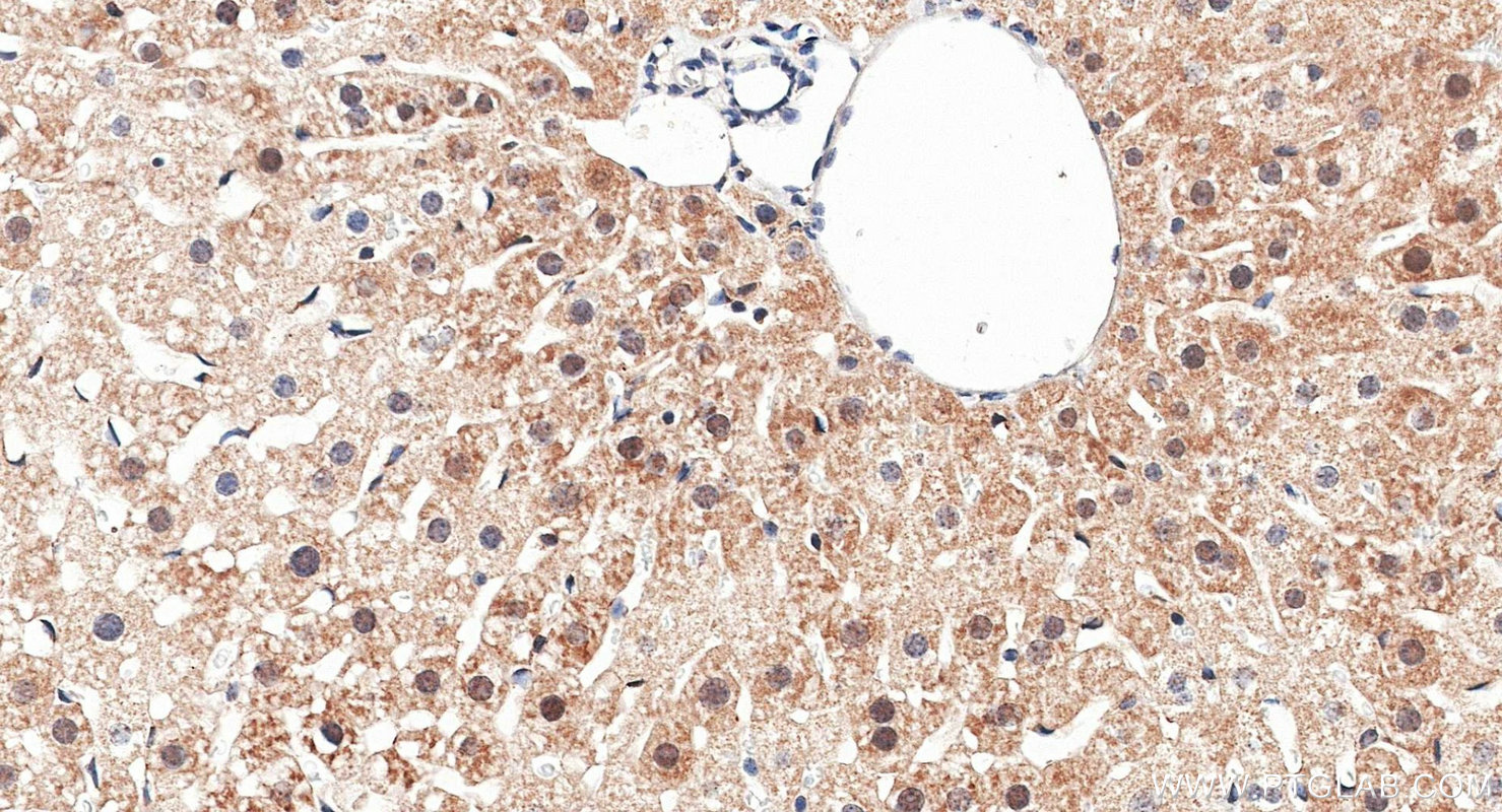 IHC staining of mouse liver using 28677-1-AP IHC staining of mouse liver using 28677-1-AP
