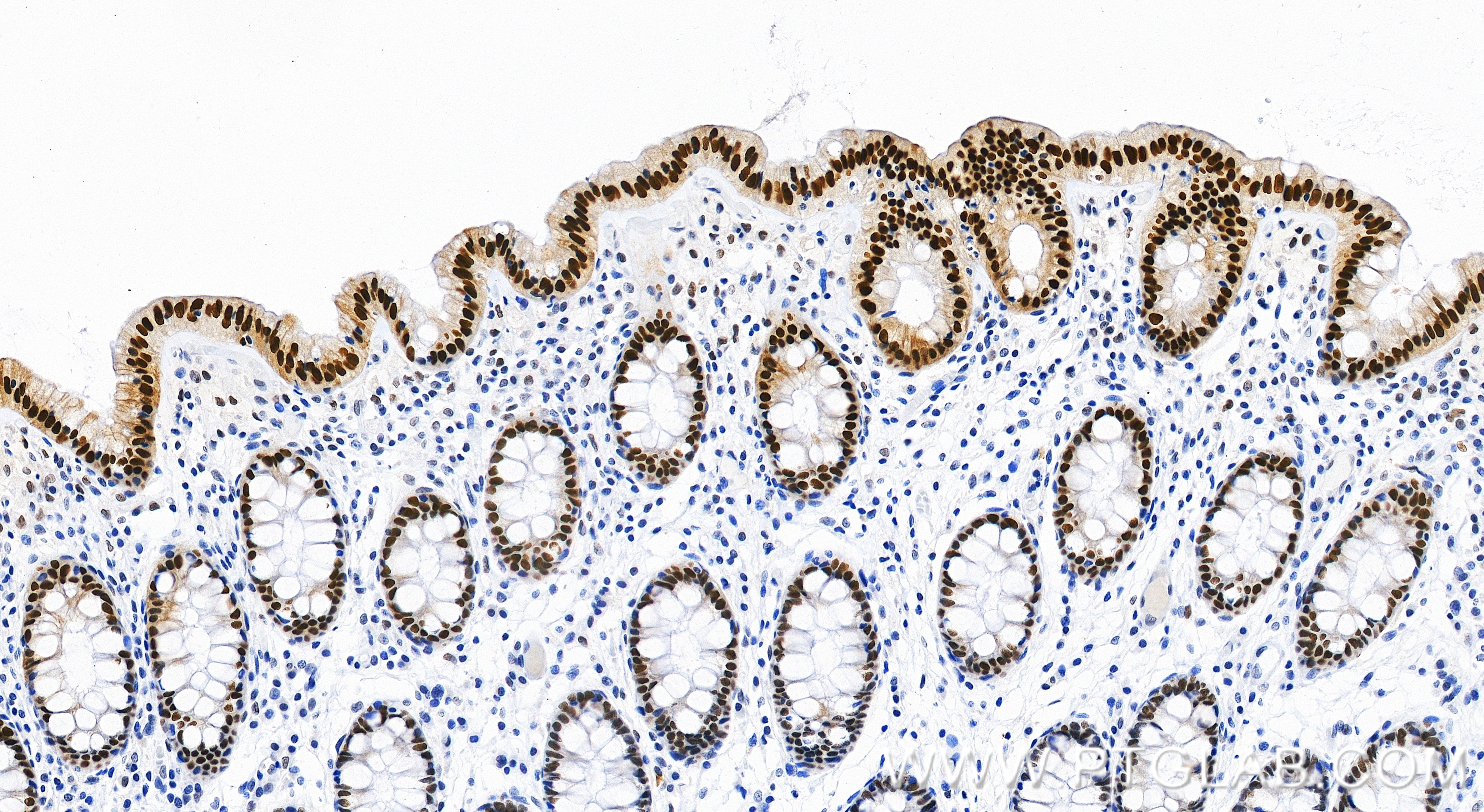 IHC staining of human colon using 87677-3-RR IHC staining of human colon using 87677-3-RR