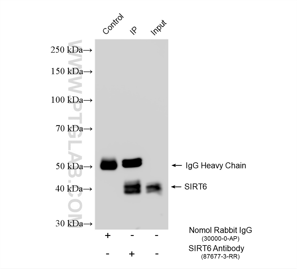 IP experiment of HeLa using 87677-3-RR IP experiment of HeLa using 87677-3-RR