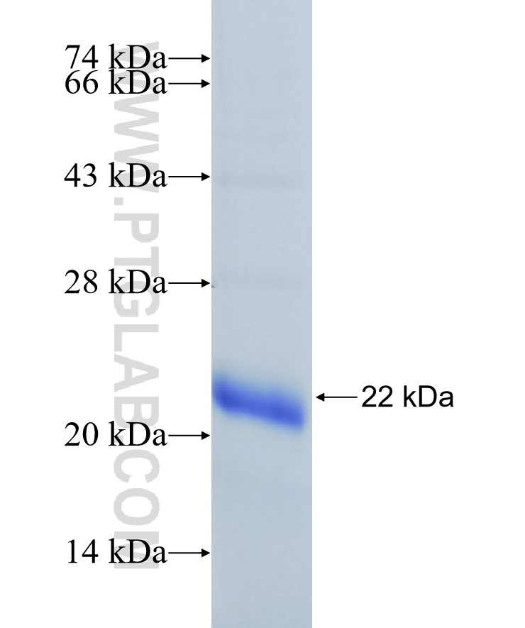 SIRT6 fusion protein Ag29181 SDS-PAGE