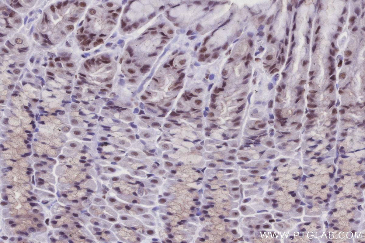 IHC staining of rat stomach using 12994-1-AP IHC staining of rat stomach using 12994-1-AP