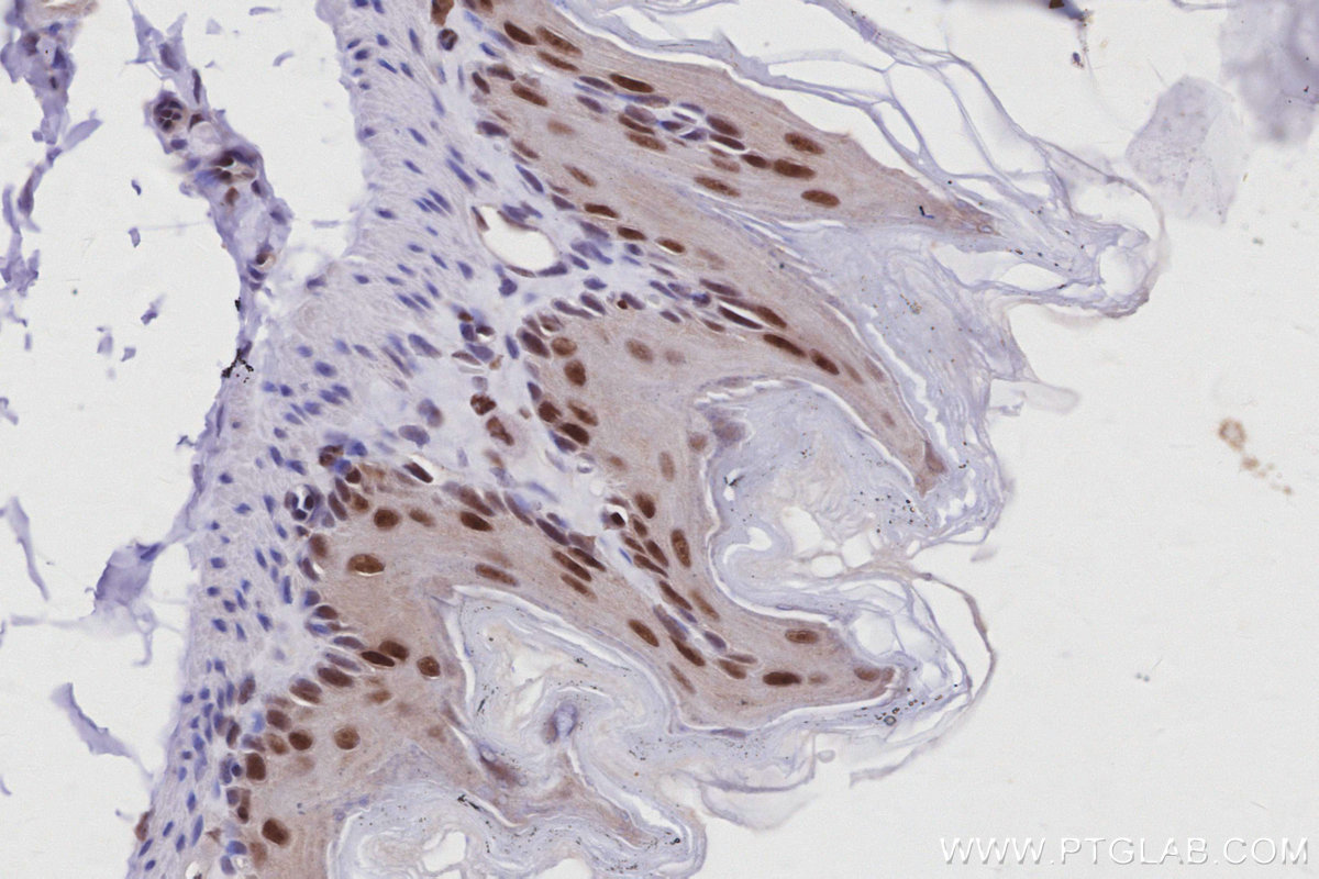 IHC staining of mouse stomach using 12994-1-AP IHC staining of mouse stomach using 12994-1-AP
