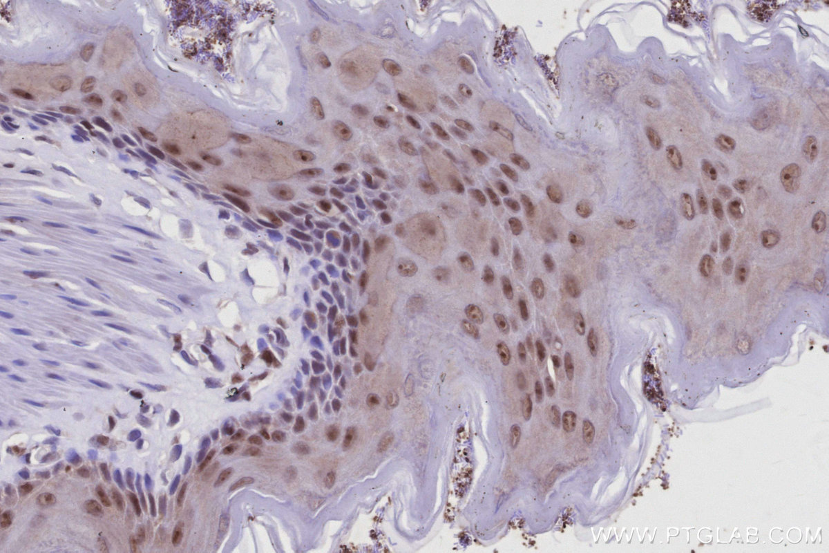 IHC staining of rat stomach using 12994-1-AP IHC staining of rat stomach using 12994-1-AP