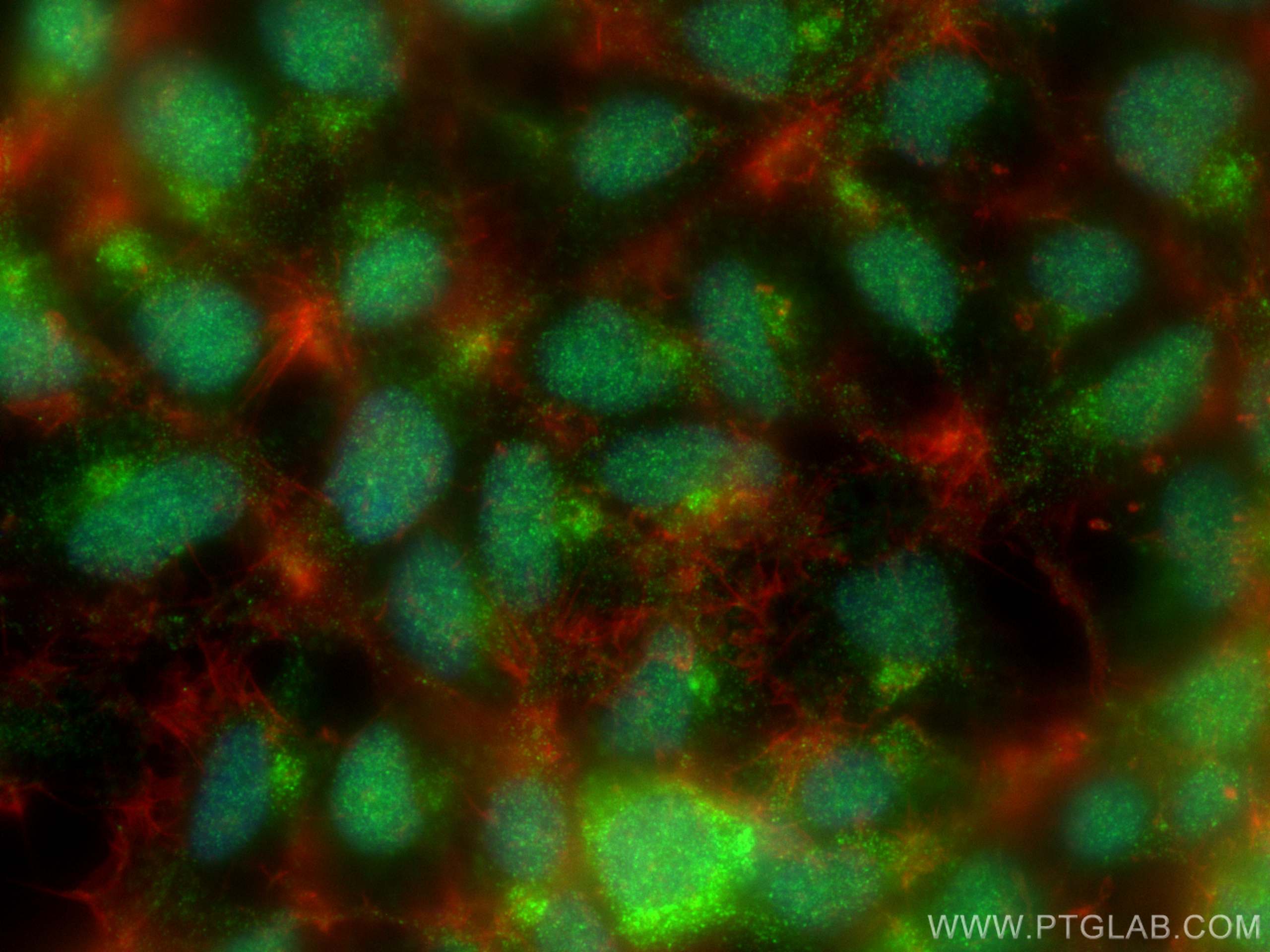 IF Staining of HEK-293 using 29729-1-AP