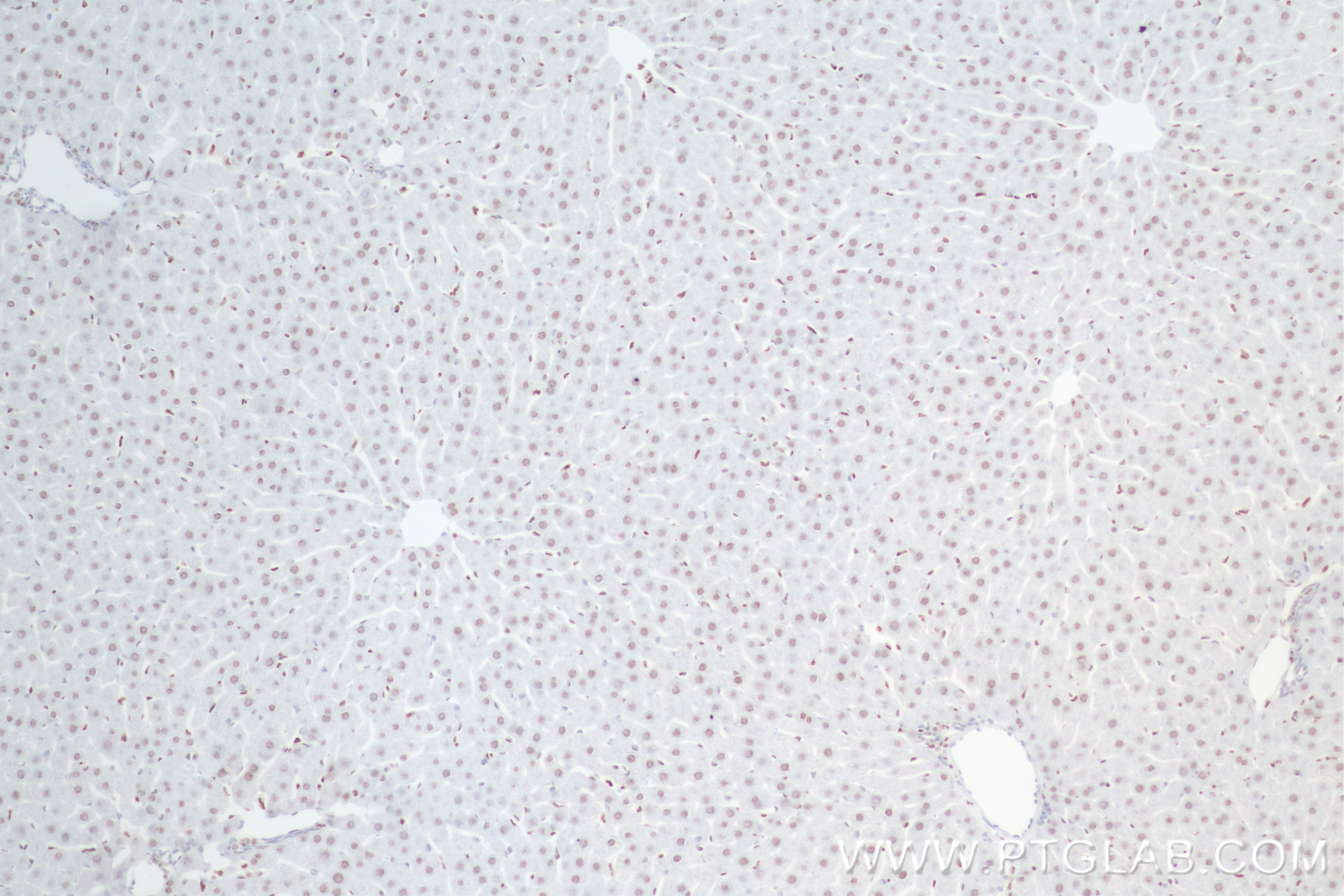 IHC staining of rat liver using 84805-4-RR (same clone as 84805-4-PBS)
