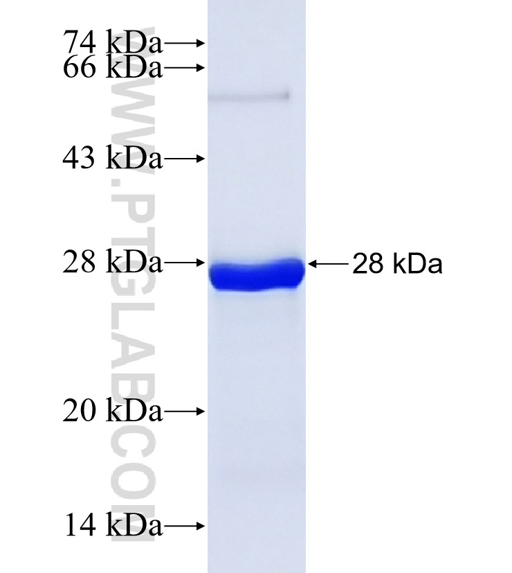 SIRT7 fusion protein Ag29149 SDS-PAGE SIRT7 fusion protein Ag29149 SDS-PAGE
