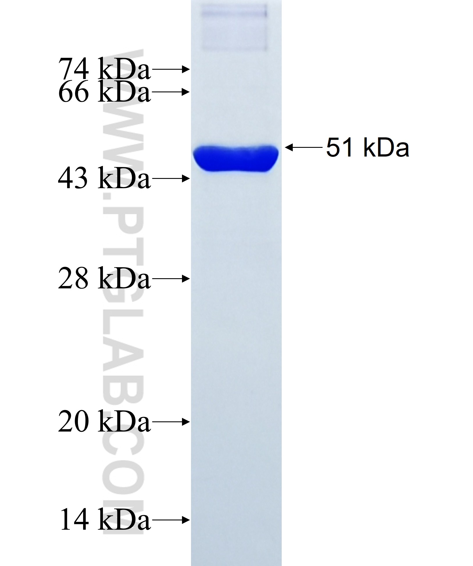 SIRT7 fusion protein Ag31770 SDS-PAGE SIRT7 fusion protein Ag31770 SDS-PAGE