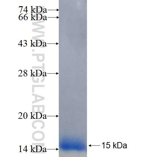 SIVA1 fusion protein Ag25753 SDS-PAGE SIVA1 fusion protein Ag25753 SDS-PAGE