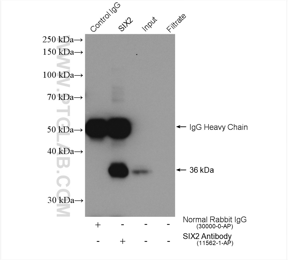 IP experiment of HEK-293 using 11562-1-AP