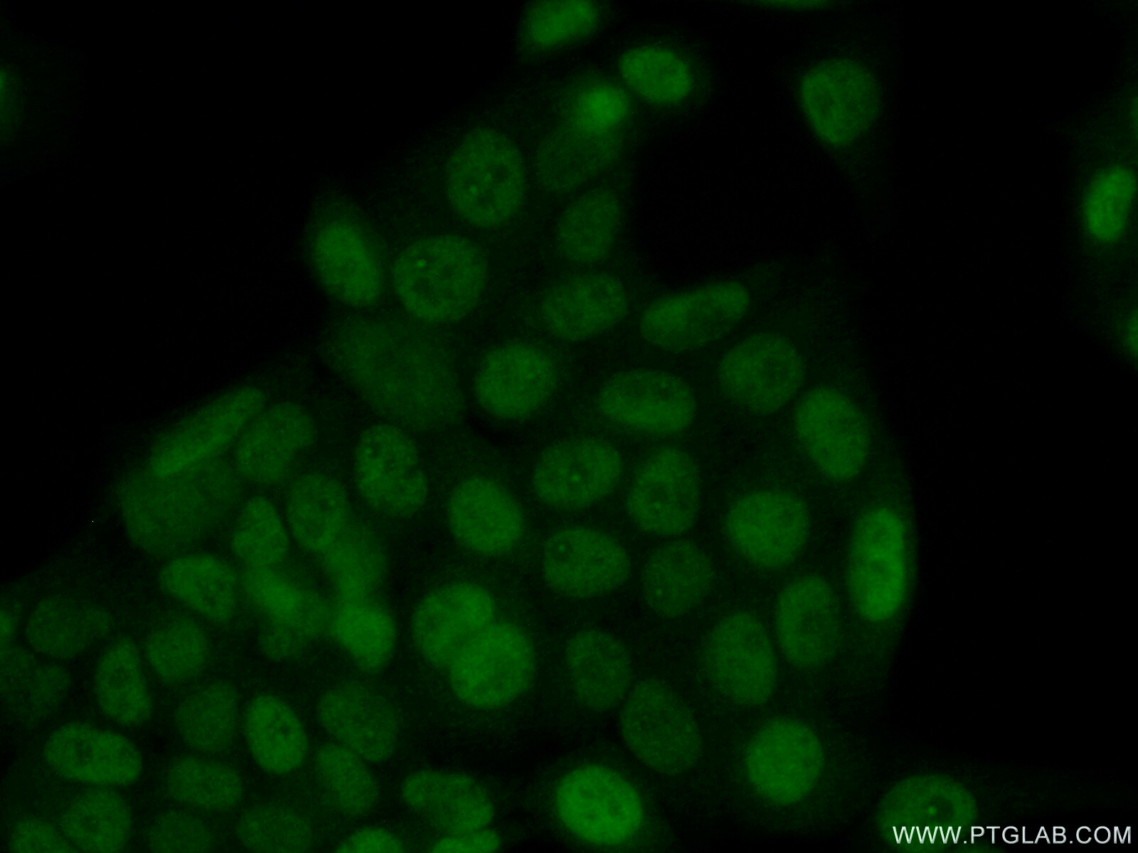 IF Staining of HeLa using 21305-1-AP