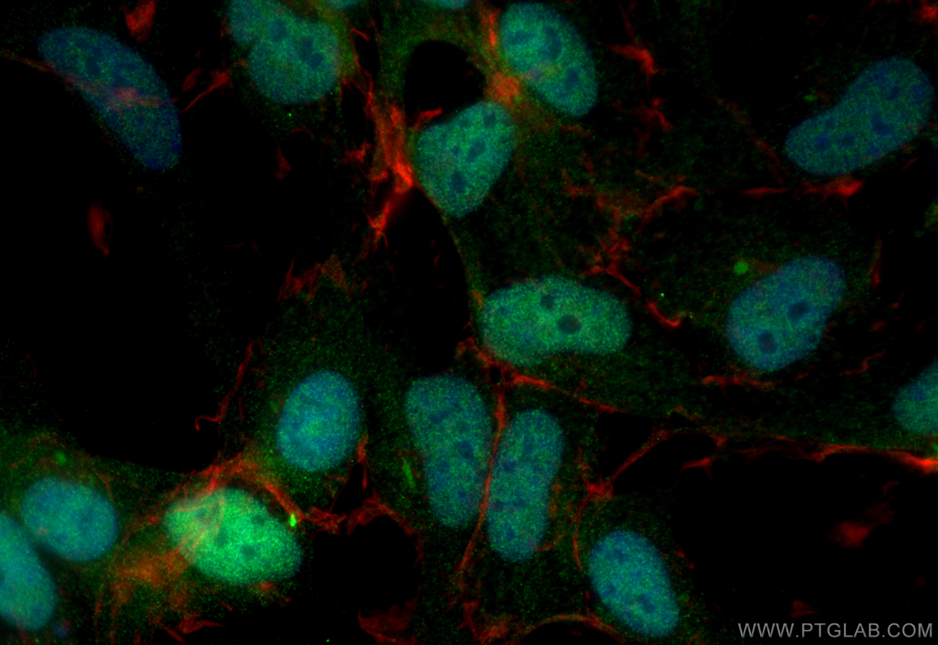 IF Staining of HEK-293 using 21305-1-AP