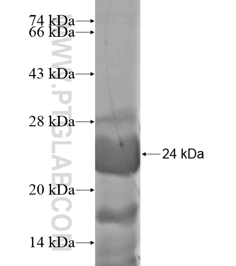 SIX5 fusion protein Ag19390 SDS-PAGE SIX5 fusion protein Ag19390 SDS-PAGE