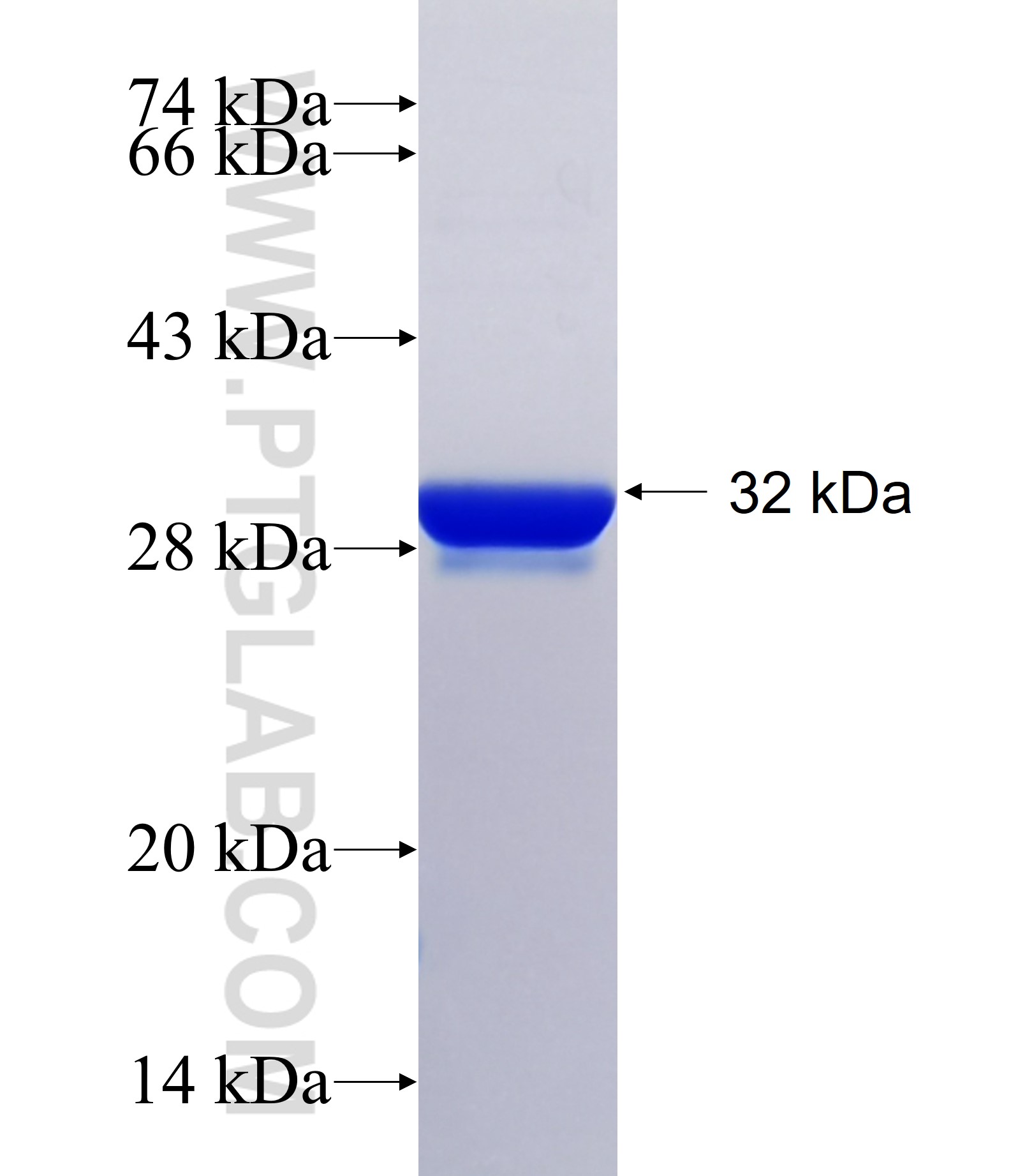 SIX6 fusion protein Ag15291 SDS-PAGE SIX6 fusion protein Ag15291 SDS-PAGE