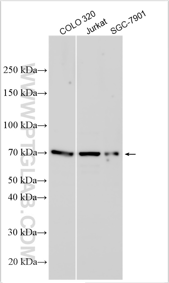 WB analysis using 30610-1-AP
