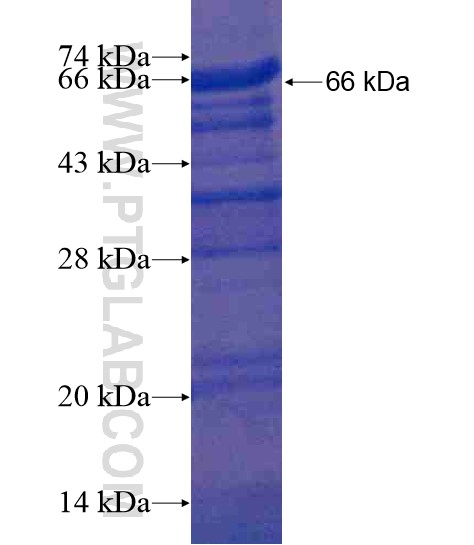 SKAP2 fusion protein Ag18827 SDS-PAGE