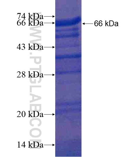 SKAP2 fusion protein Ag18827 SDS-PAGE SKAP2 fusion protein Ag18827 SDS-PAGE