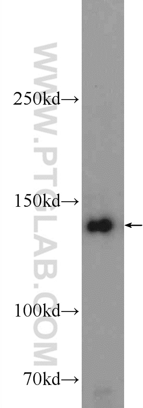 WB analysis of HEK-293 using 11462-1-AP