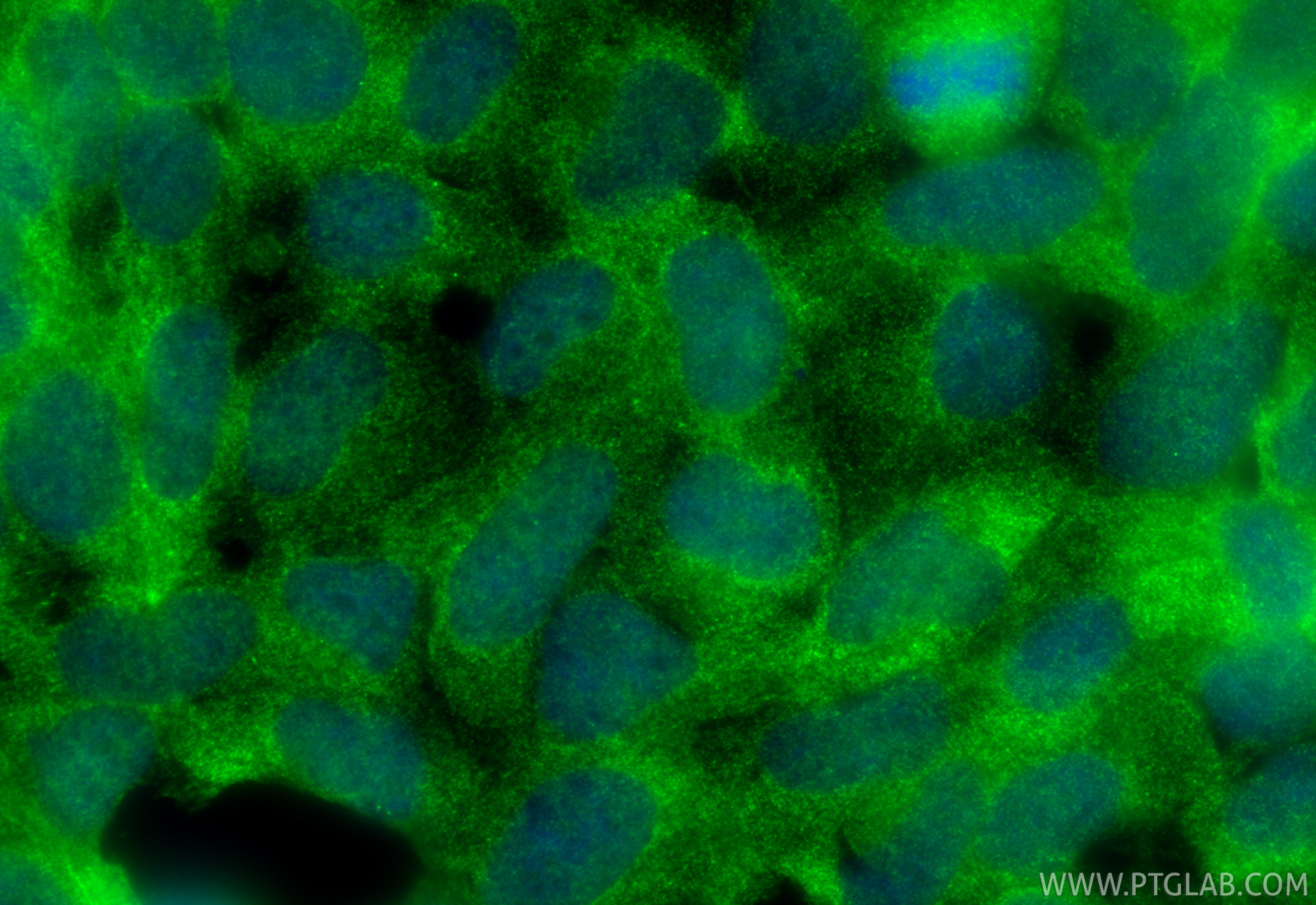IF Staining of HEK-293 using 68547-1-Ig (same clone as 68547-1-PBS)