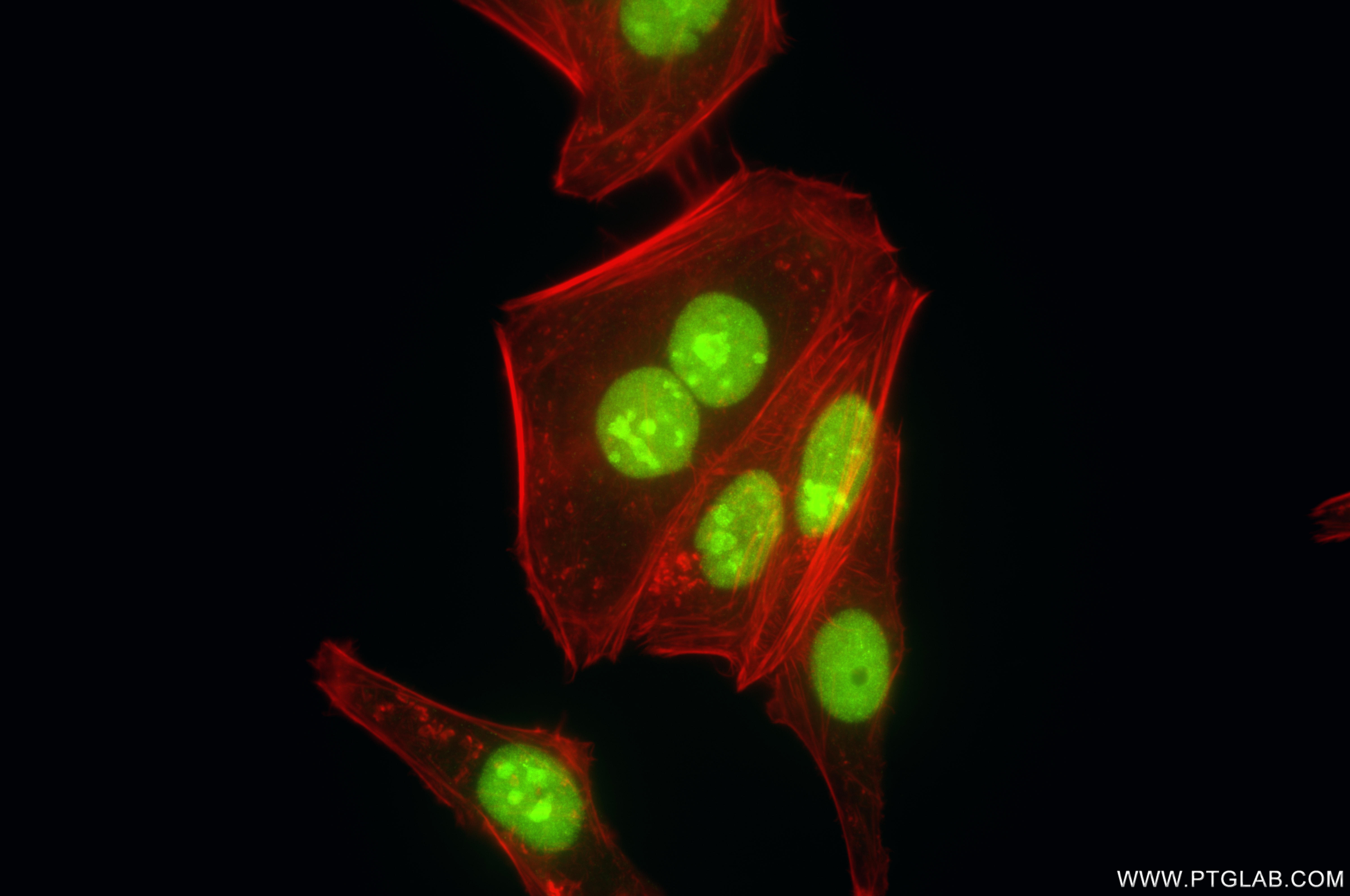 Immunofluorescent analysis of (4% PFA) fixed HepG2 cells using SKIV2L2 antibody (86536-1-RR, Clone: 251430D11 ) at dilution of 1:800 and CoraLite®488-Conjugated Goat Anti-Rabbit IgG(H+L) (<a class='green' href='/productredirect?CatalogNo=SA00013-2' target='_blank'>SA00013-2</a>), CL594-Phalloidin (red). IF Staining of HepG2 using 86536-1-RR