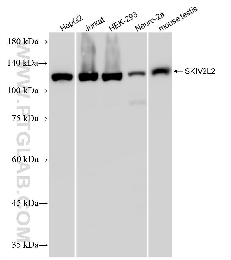 Various lysates were subjected to SDS PAGE followed by western blot with 86536-1-RR (SKIV2L2 antibody) at dilution of 1:10000 incubated at room temperature for 1.5 hours. WB analysis using 86536-1-RR