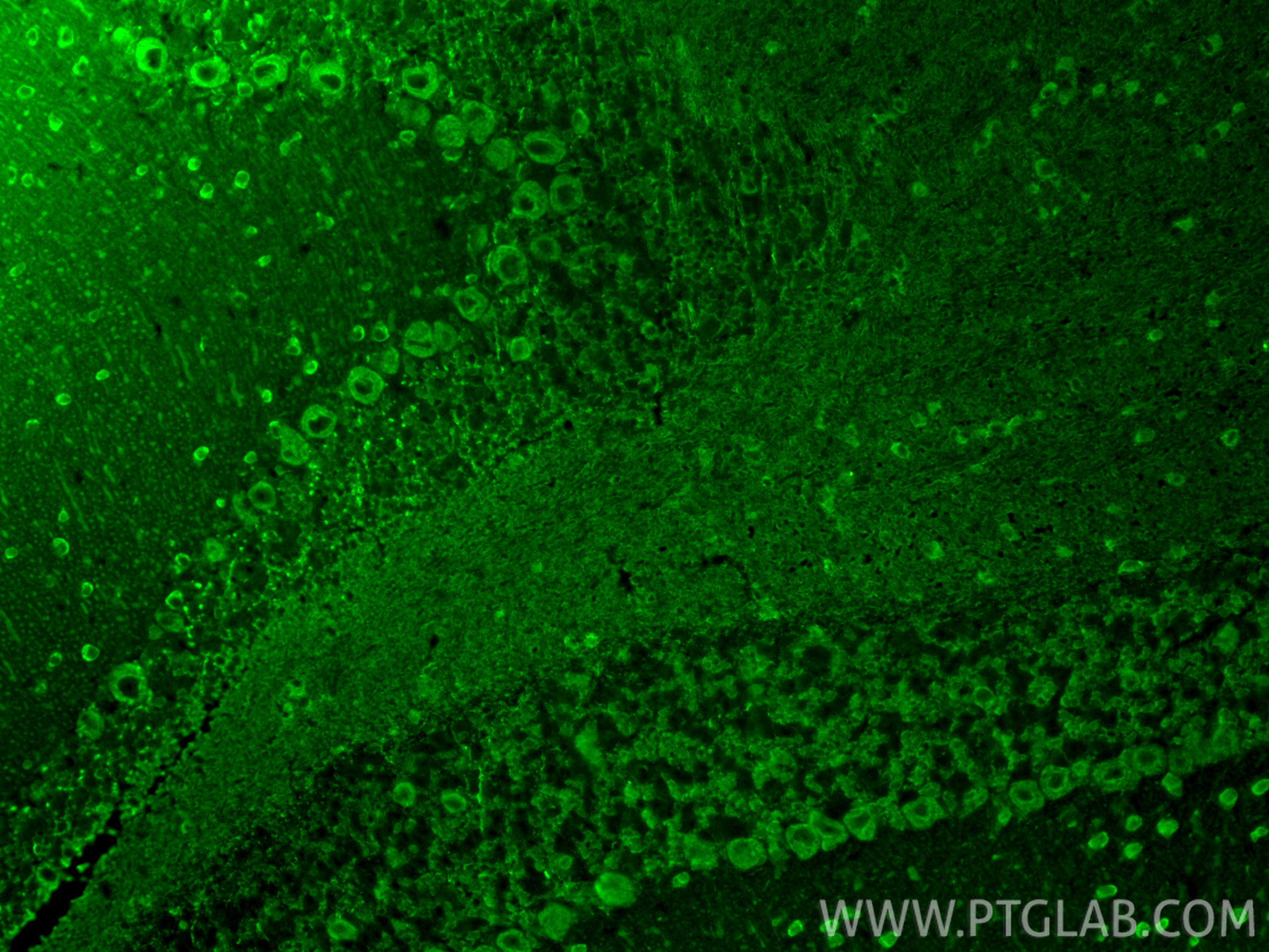 IF Staining of mouse cerebellum using 55370-1-AP