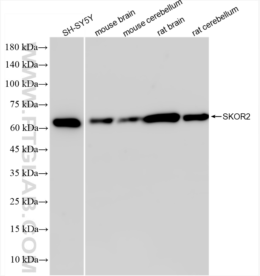 WB analysis using 84303-1-RR