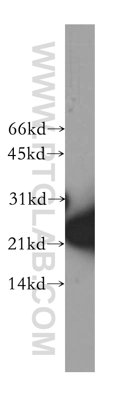 SKP1 Polyclonal antibody