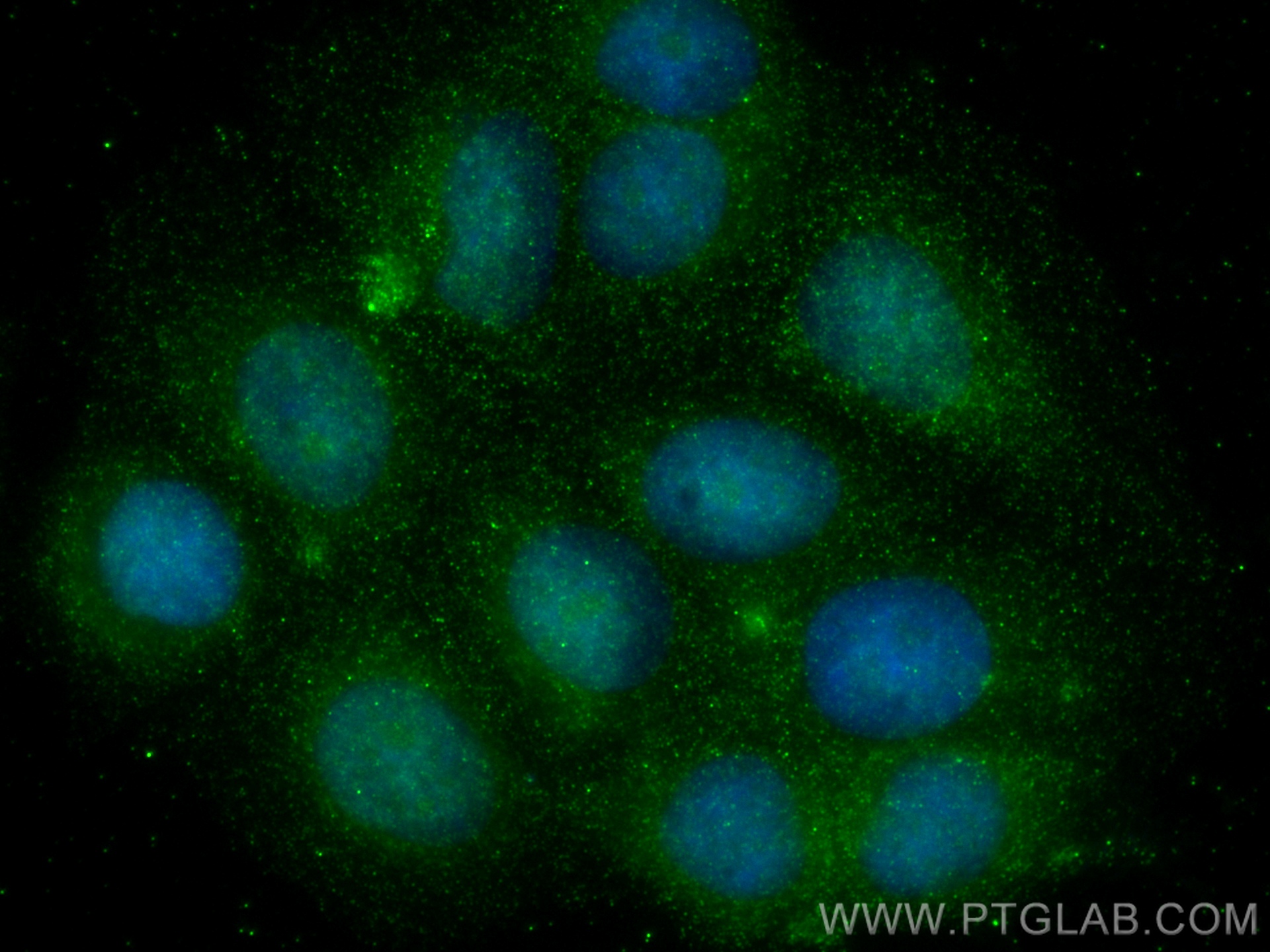 IF Staining of MCF-7 using 67745-1-Ig (same clone as 67745-1-PBS)