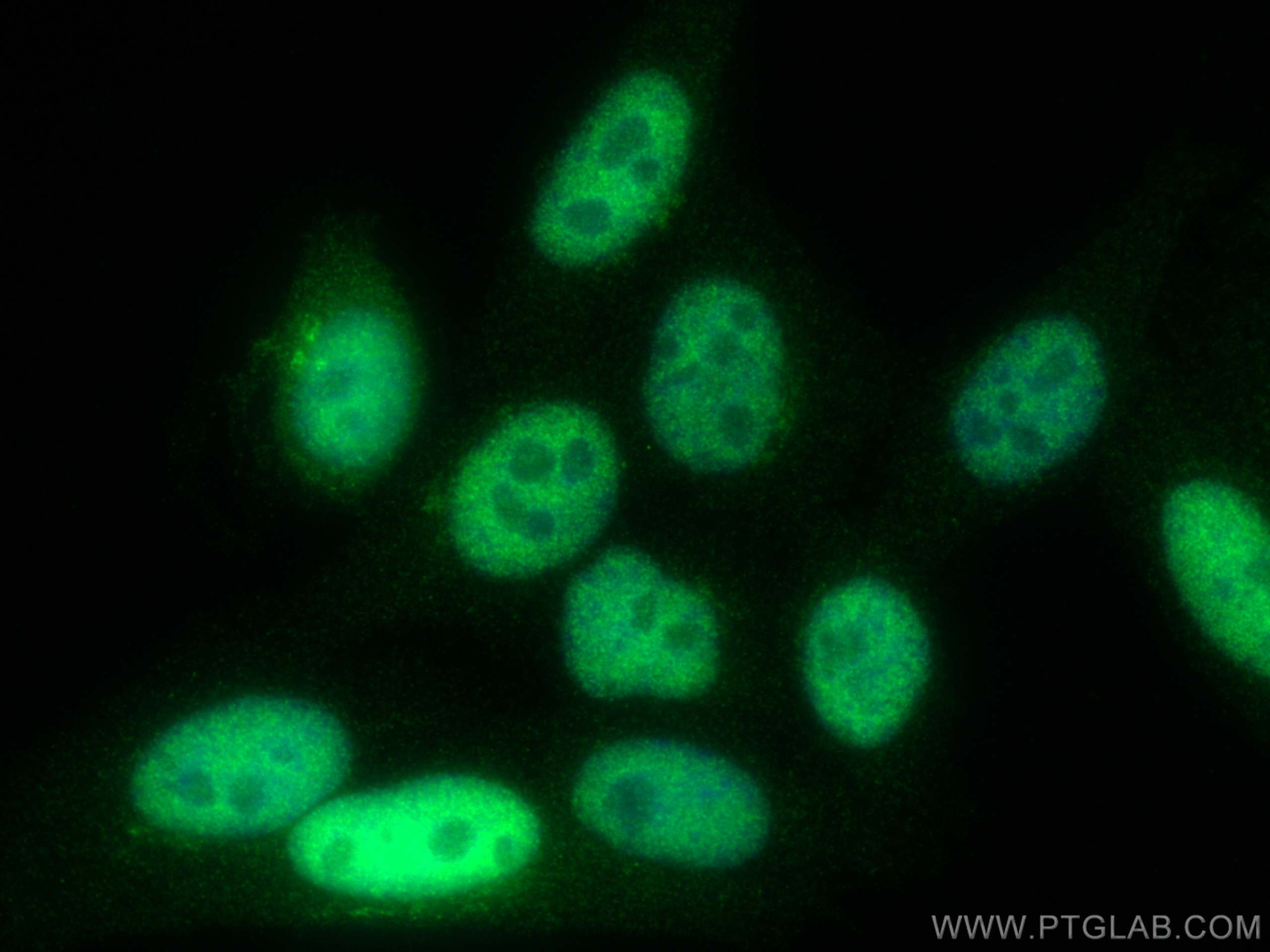 IF Staining of HepG2 using 15010-1-AP