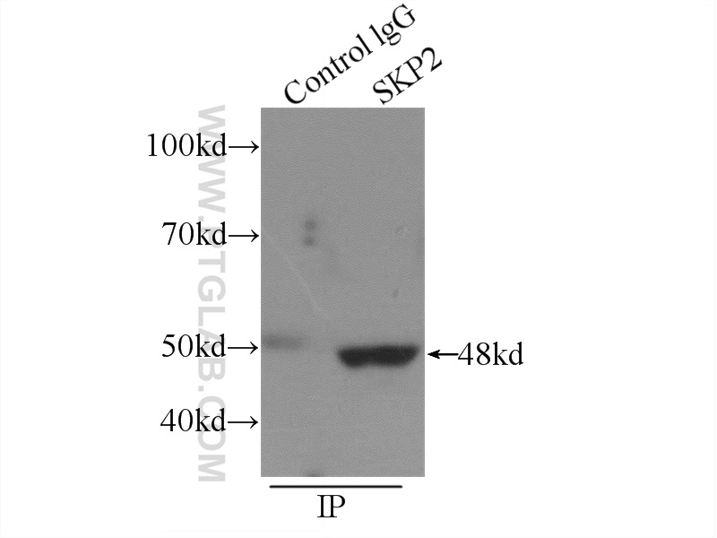 IP experiment of HEK-293 using 15010-1-AP