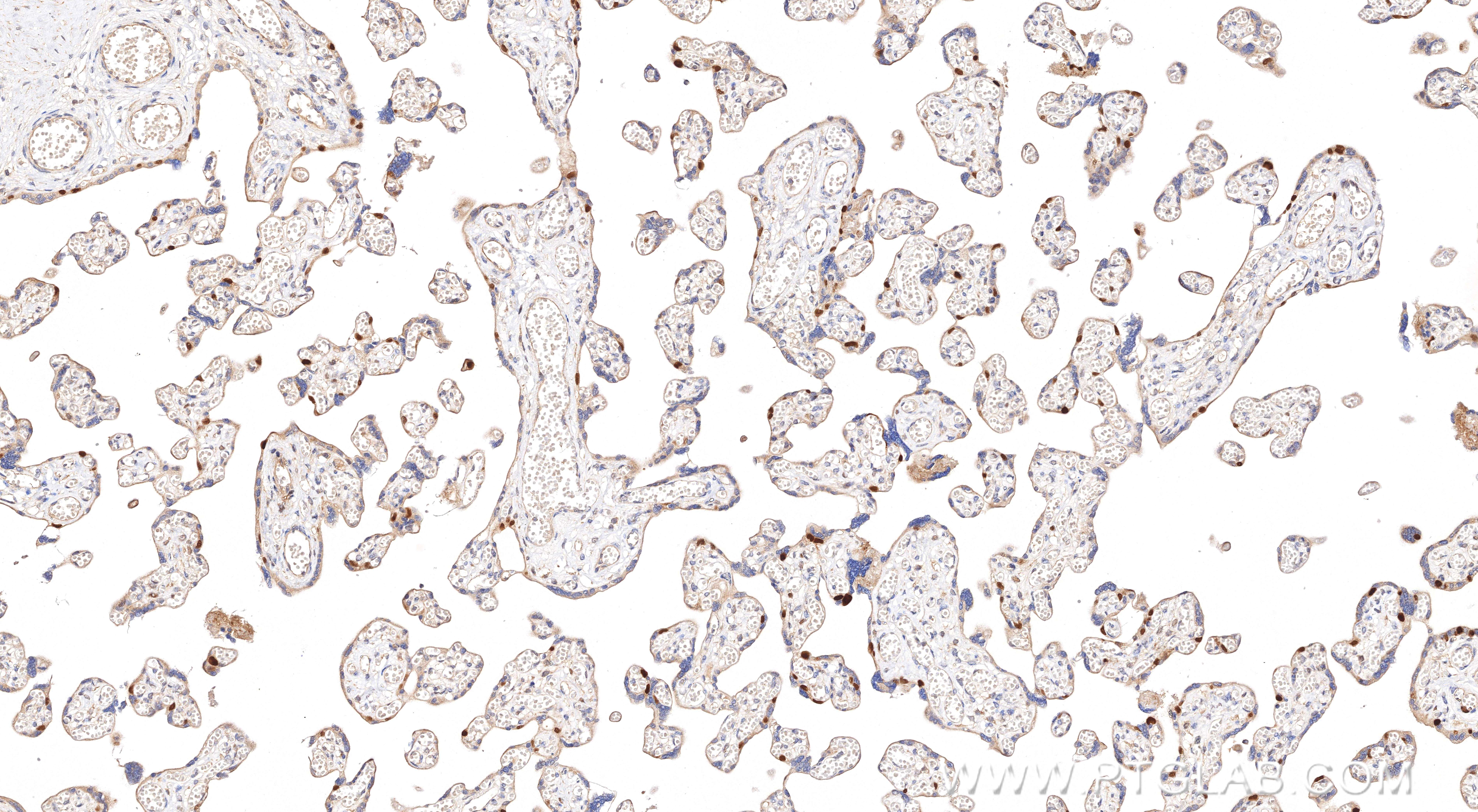 IHC staining of human placenta using 85670-4-RR