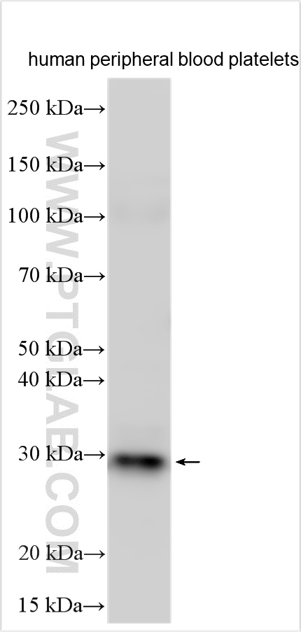 WB analysis using 14152-1-AP